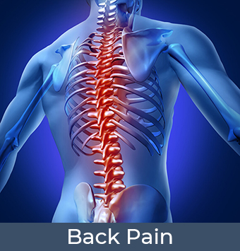 Read more about the article Acute Back Spasms