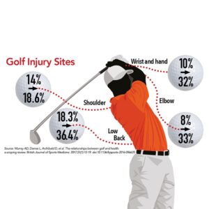 Read more about the article Golf Injuries